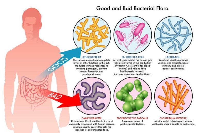 Diagram of leaky gut treatment & gut bacteria